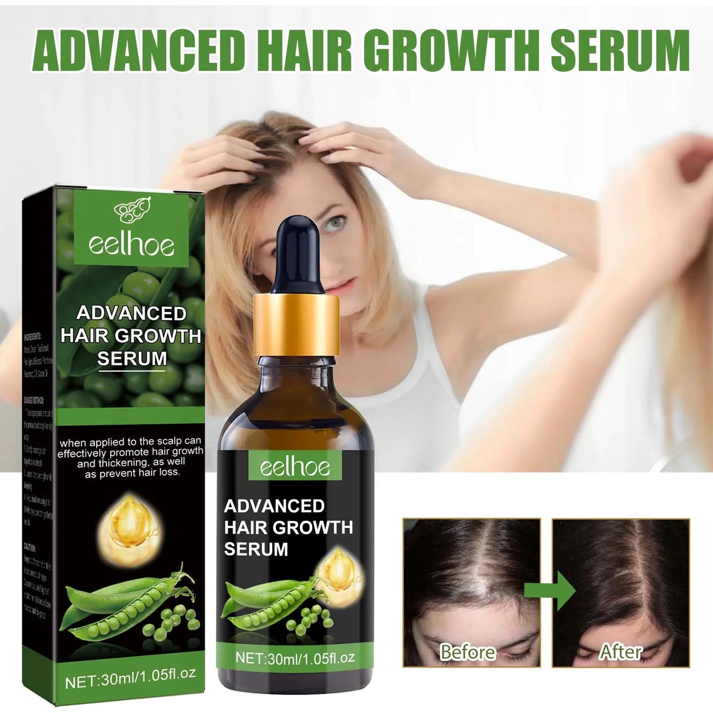 Biotin Hair Growth Serum,Advanced Hair Growth Serum,Hair Growth Serum Promotes Hair Growth, Moisturizes, Strengthens Hair and Nourishes the Scalp for Both Men and Women 30Ml