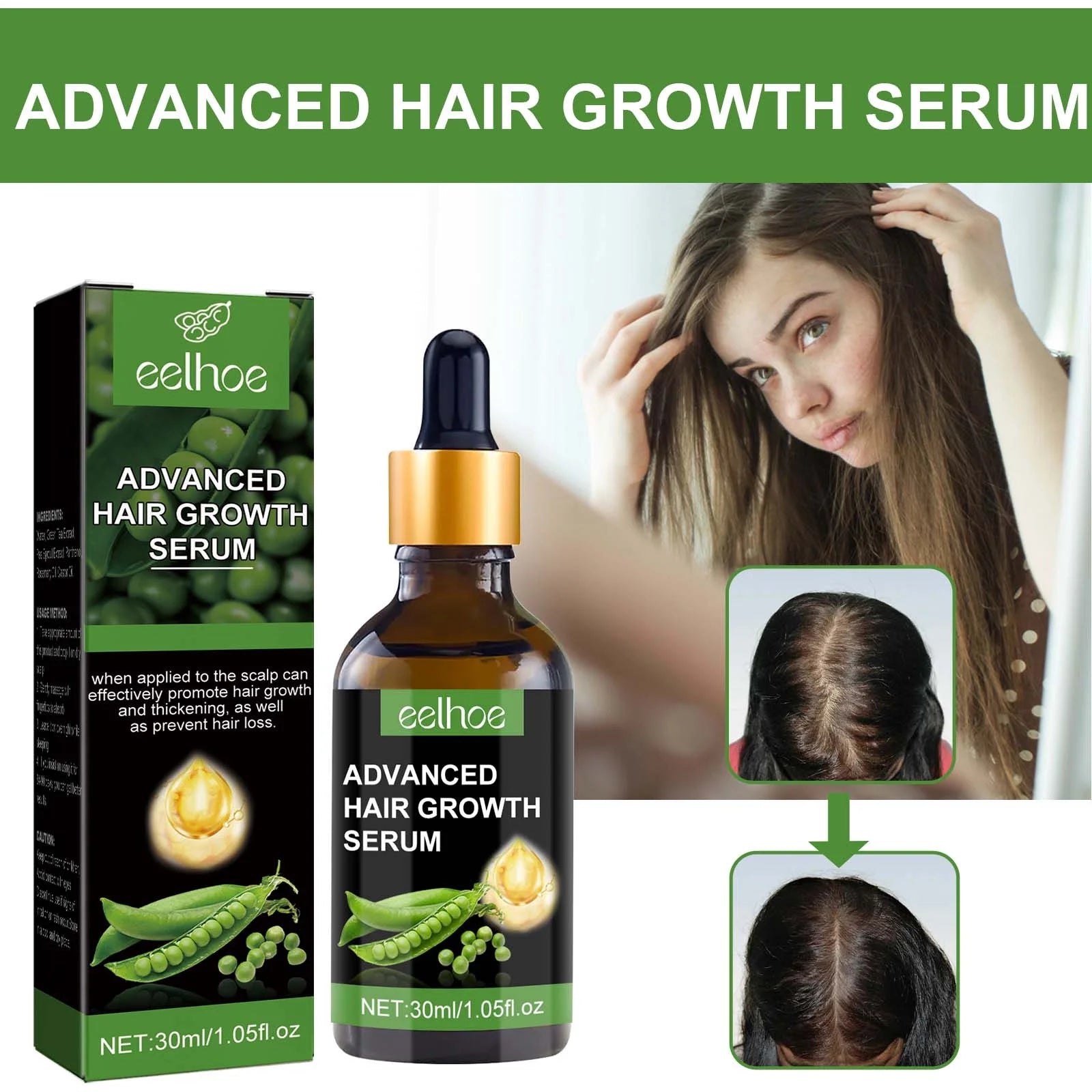 Biotin Hair Growth Serum,Advanced Hair Growth Serum,Hair Growth Serum Promotes Hair Growth, Moisturizes, Strengthens Hair and Nourishes the Scalp for Both Men and Women 30Ml