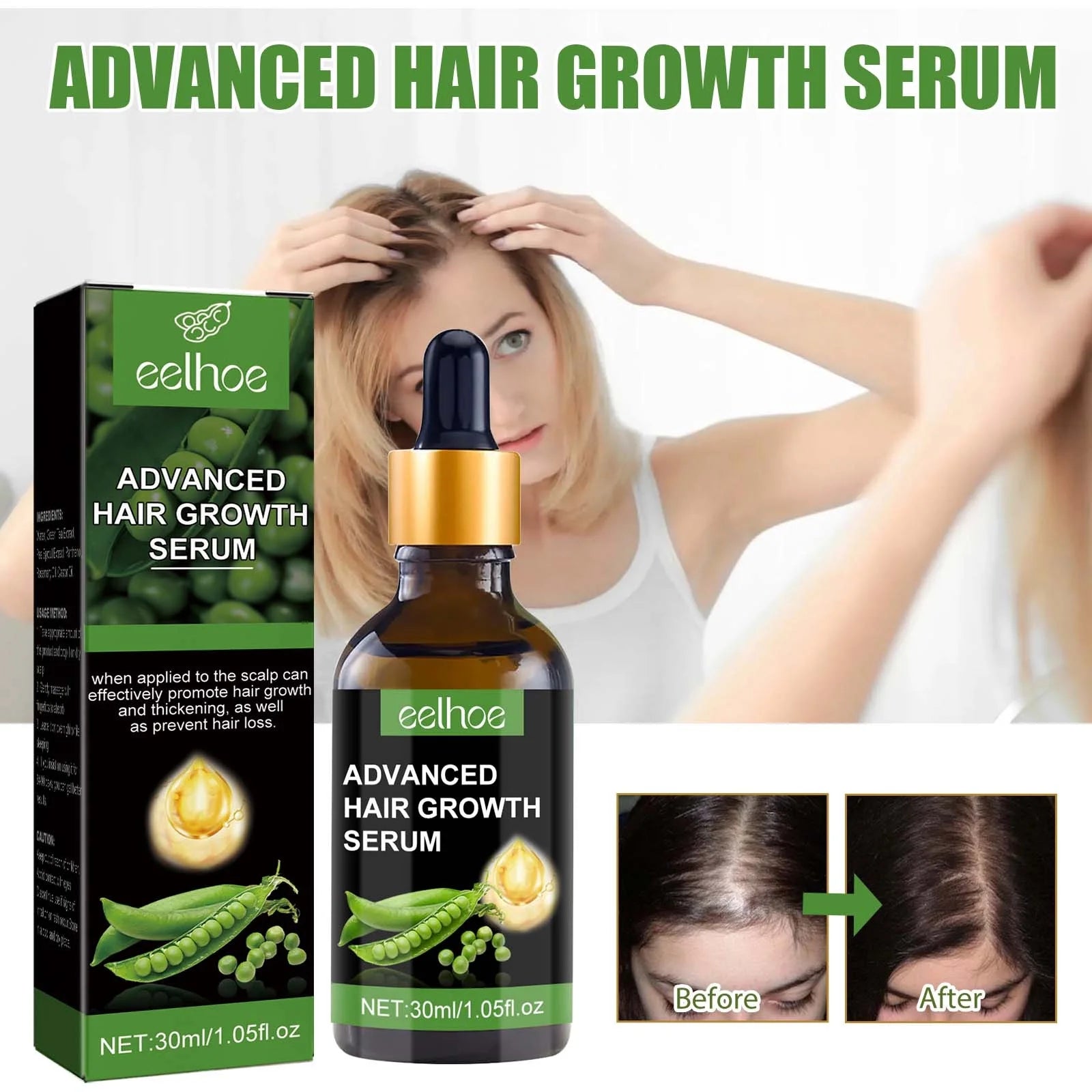 Biotin Hair Growth Serum,Advanced Hair Growth Serum,Hair Growth Serum Promotes Hair Growth, Moisturizes, Strengthens Hair and Nourishes the Scalp for Both Men and Women 30Ml