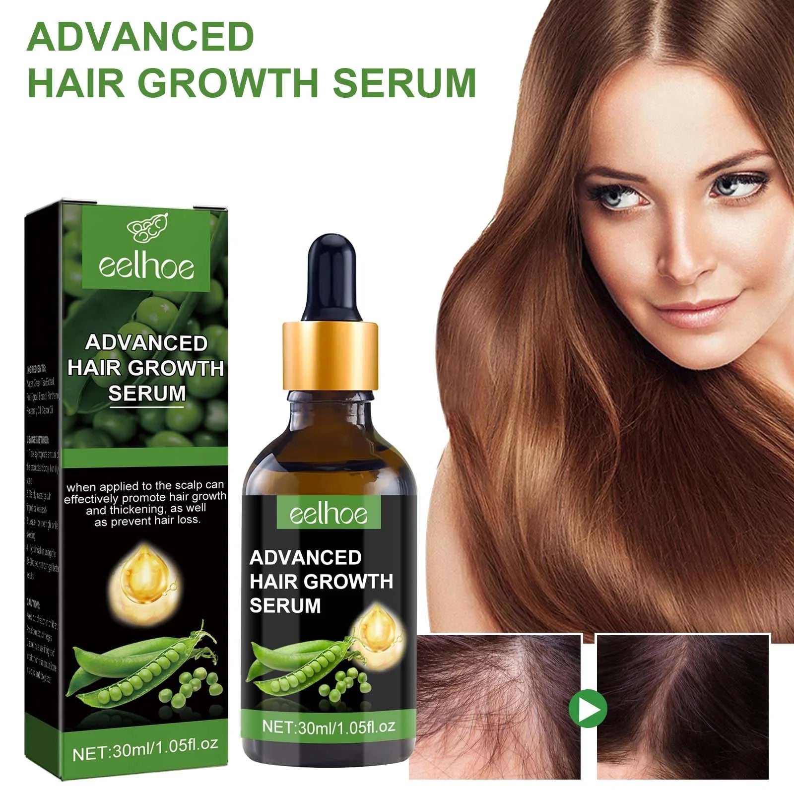 Biotin Hair Growth Serum,Advanced Hair Growth Serum,Hair Growth Serum Promotes Hair Growth, Moisturizes, Strengthens Hair and Nourishes the Scalp for Both Men and Women 30Ml
