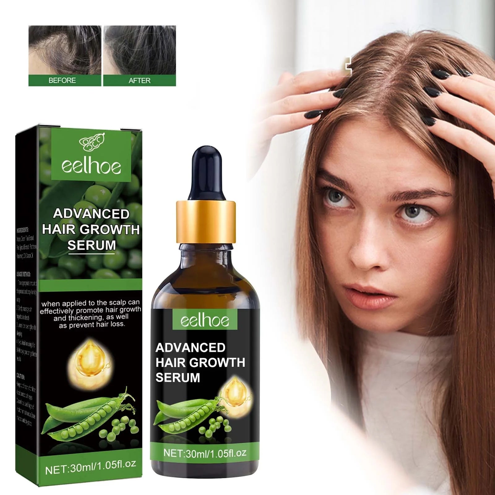 Biotin Hair Growth Serum,Advanced Hair Growth Serum,Hair Growth Serum Promotes Hair Growth, Moisturizes, Strengthens Hair and Nourishes the Scalp for Both Men and Women 30Ml